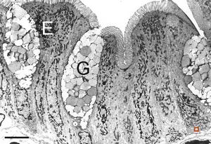 normal mucosa - duodenum - enterocytes and goblet cells normal mucosa - duodenum - enterocytes and goblet cells